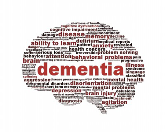 Dementia quiz pic